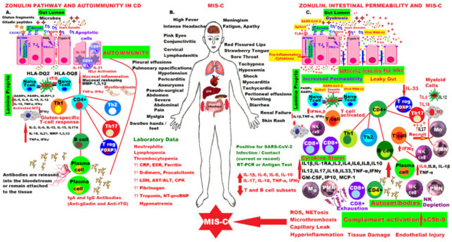 【佳学基因检测】乳糜泻与新冠病毒 COVID感染的基因根源
